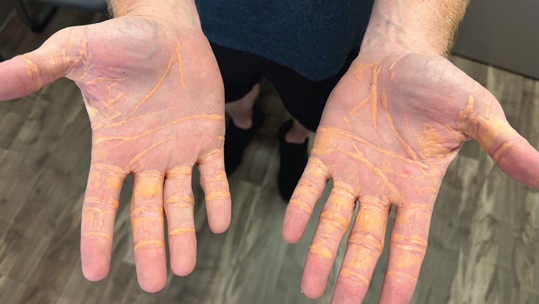 transformación corporal