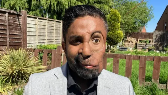 “Se negaron a atenderme en un café por mi cara”