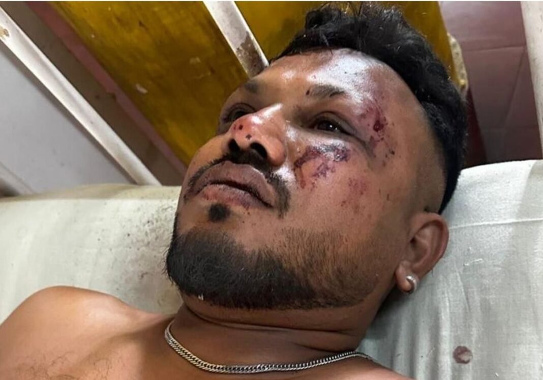 Vishwash Kumar Ramesh, el superviviente del asiento 11A: «Treinta segundos después del despegue, hubo un ruido fuerte y luego el avión se estrelló»