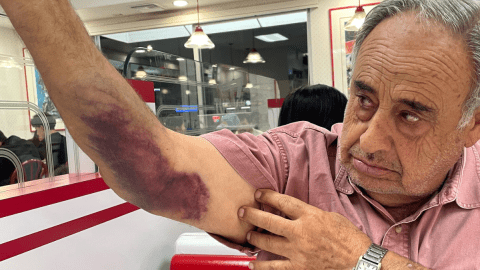 Octogenario Demanda a ICE por Millones Tras Presunta Agresion en Redada Migratoria