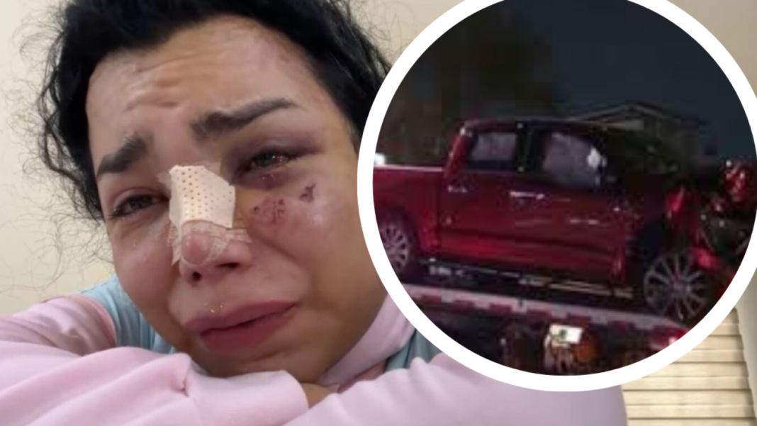 Accidente Automovilístico de Paola Suárez: Secuelas Físicas y la Urgente Necesidad de Terapia Psicológica