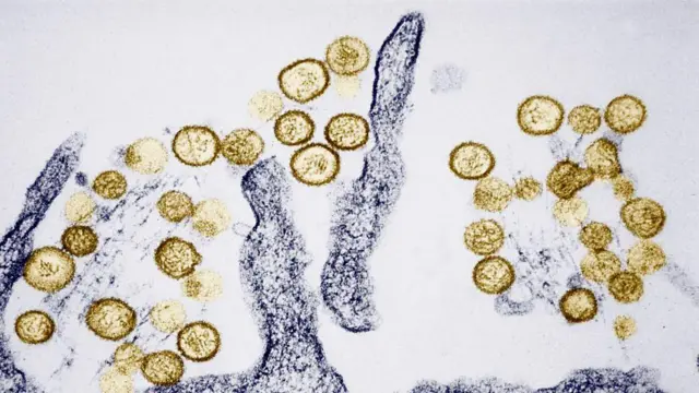 Hantavirus Andes Alerta Sanitaria Internacional Tras Brote Mortal en Crucero