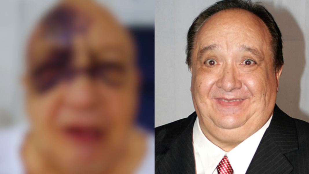 Luis de Alba Repercusiones Accidente Vulnerabilidad Figura Publica