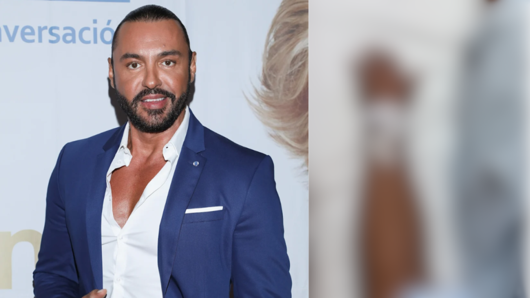 Latin Lover Entre el Quirofano y el Legado de Multiples Cirugias en su Carrera
