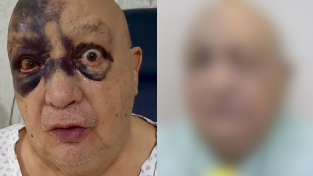 Luis de Alba: Resiliencia Escénica y el Inquebrantable Compromiso de un Ícono de la Comedia