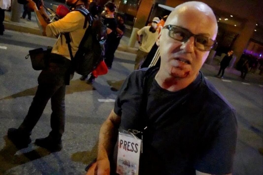 Demanda por Agresión Policial en Los Ángeles: Fotoperiodista Contra LAPD y la Ciudad Demanda por Agresion Policial en Los Angeles Fotoperiodista Contra LAPD y la Ciudad