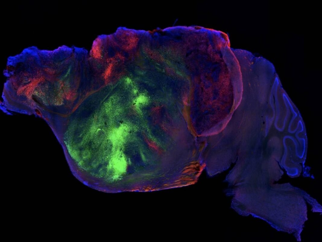 Xenocorticacion La Integracion de Celulas Humanas en Cerebros de Roedores Redefine los Limites de la Neurociencia