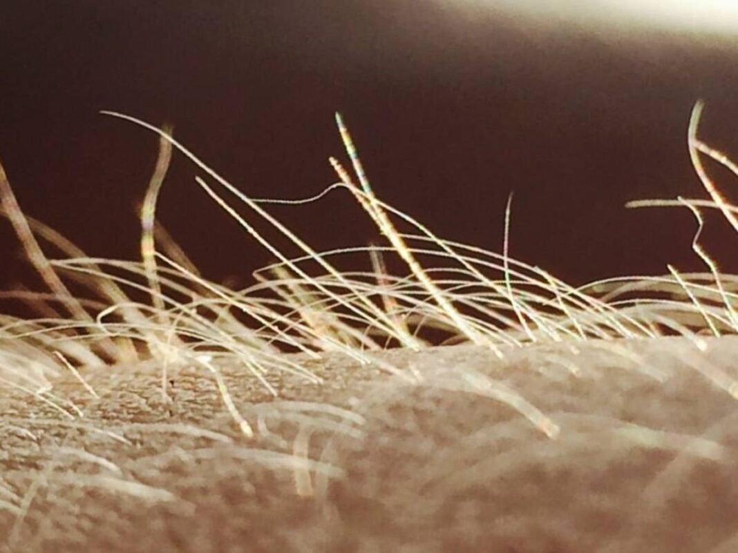 Un órgano sensorial desconocido, clave en el origen del picor crónico: Un avance de la ciencia Un organo sensorial desconocido clave en el origen del picor cronico un avance de la ciencia